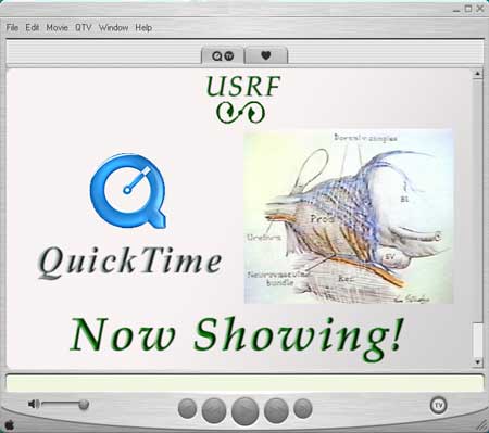 Now Showing! Radical Retropubic Prostatectomy by Patrick C. Walsh, M.D.